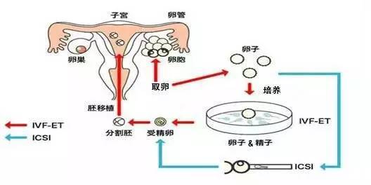 石家庄助孕